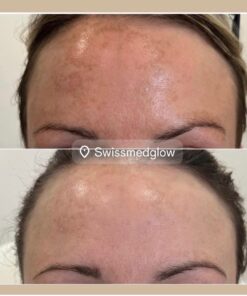 Alternative view of SkinCeuticals Discoloration Defense Serum mit 1.8% Tranexamsäure 30ml