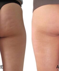 Alternative view of ZO Skin Health Body Smoothing Creme Cellulite Control 150ml